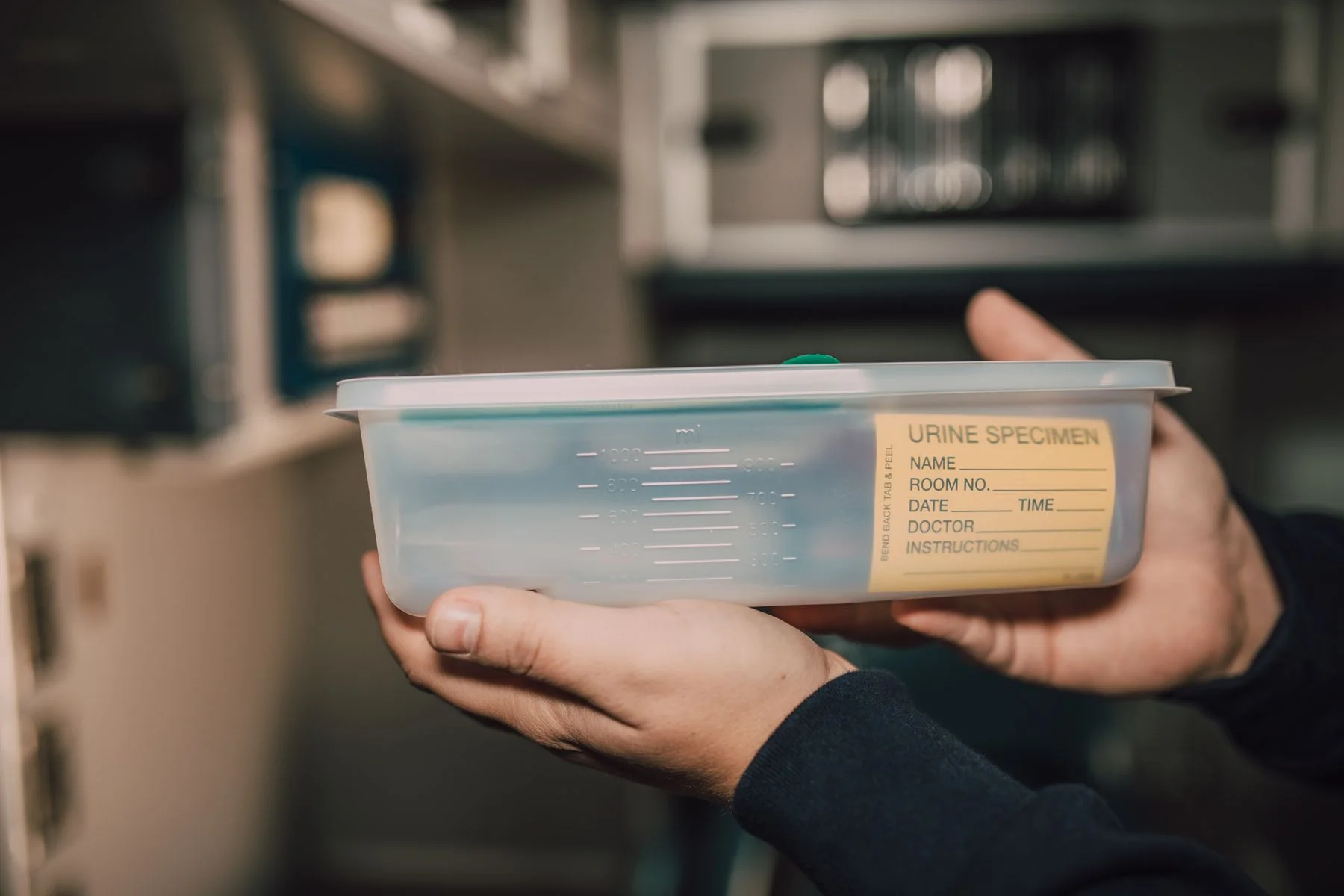 Handen houden een potje voor urineonderzoek vast in een laboratorium